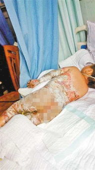 4岁男童全麻拔牙竟离世，背后真相令人揪心