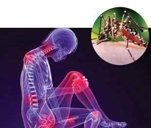 基孔肯雅热致残，广东佛山疫情形势严峻