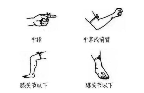 惊险！印度1岁男童咬死眼镜蛇竟奇迹生还