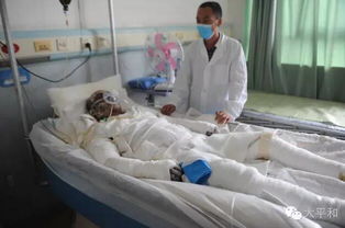 室友电瓶燃爆烧伤，对话当事人背后的惊魂时刻