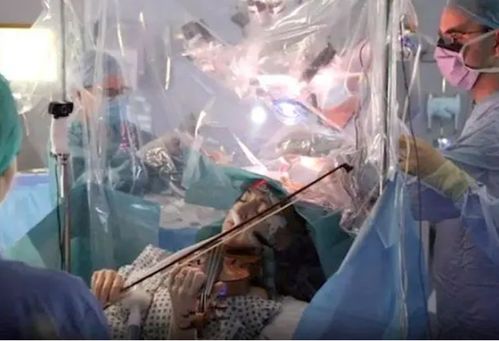 美国医生边手术边玩游戏致患者死亡，医疗安全敲响警钟！