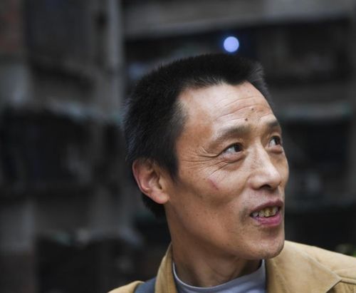 震惊！揭秘世界上最长下巴背后的故事