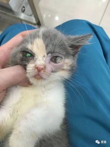 淋巴结肿大不痛？别掉以轻心！