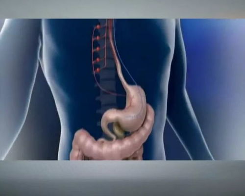 父女双双查出胃癌，背后原因令人揪心！