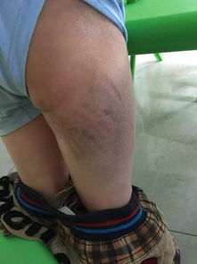 被虐待后的小猫满身伤痕