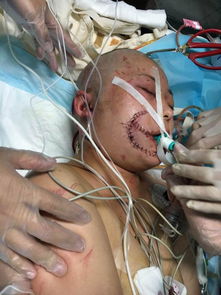 女子景区摸马肚竟被咬，度假区积极应对