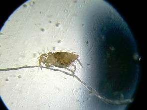 全国多地水域惊现“食脑虫”！夏日玩水需谨慎