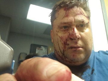 震惊！丈夫‘强奸’妻子后的那些事