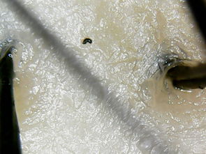 木苏里的烦恼：人真的不能没头发！