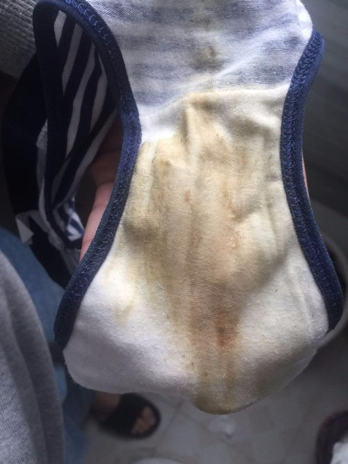 为什么建议一天一换内裤？这其中原因可不少呢！