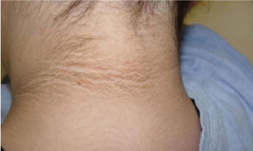 杭州女子因牛黄解毒片中砒霜之毒，全身发黑，真相令人震惊