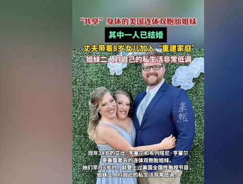 美国连体双胞胎姐妹，其中一人疑似生子背后的故事