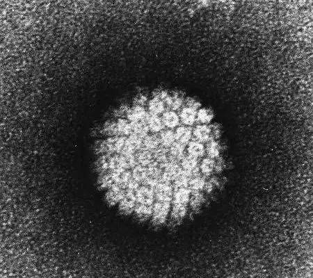 显微镜下的HPV病毒结构