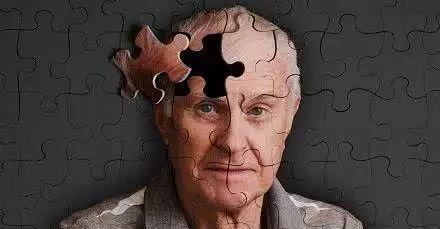 阿尔茨海默症患者表情困惑