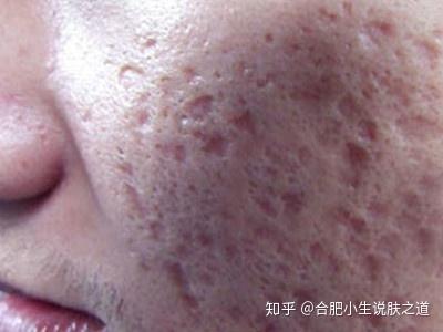 美国惊现变异动物潮，“僵尸松鼠”“触手兔”“变异鹿”轮番登场