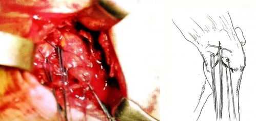 震惊！猪头离体50分钟竟被中国医生‘复活’，背后真相太惊人