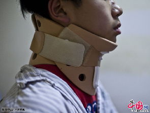 颈椎脱位影像图