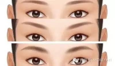 碳音球戳伤眉骨？真相竟是这般！