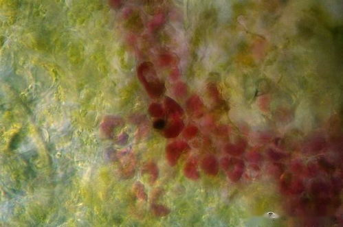 床虱重现江湖，让人防不胜防！