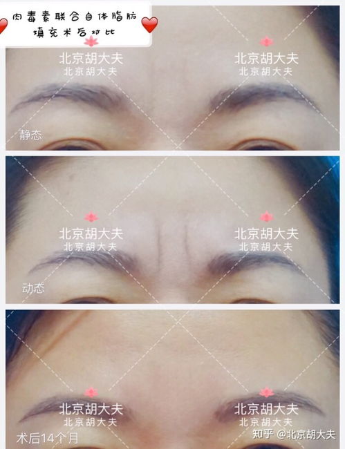 资深医生查看报告