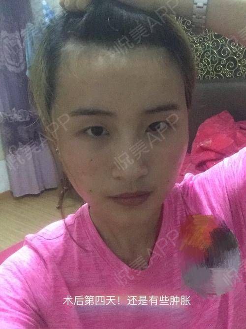 悲剧！女子被前夫殴打致死，警方已通报详情