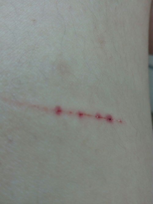 两年被家暴16次惨剧！当事人等待正义的到来