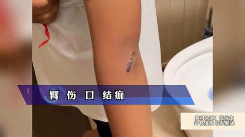 惊险！峨眉山男子挖笋遭遇神秘野兽袭击