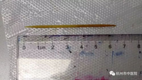 一根牙签立奇功，帮乘客挽回巨额损失