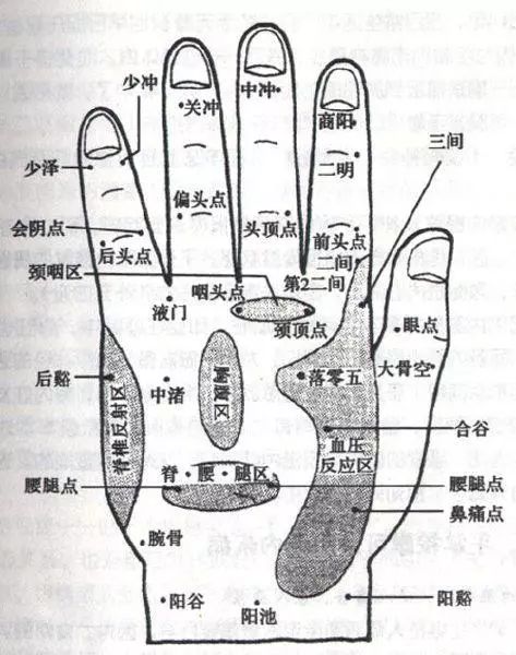 手部疼痛示意图
