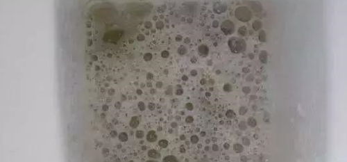 因接吻虫病住院的人群