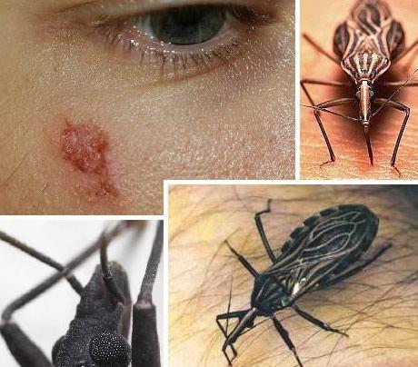 接吻虫正在吸血