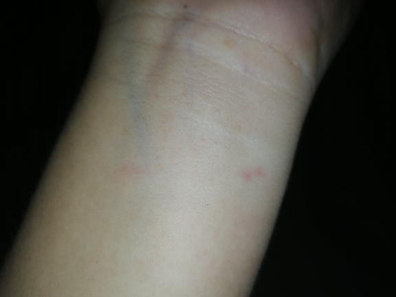 惊险！男子遭蛇咬，骑行就医途中毒发倒地